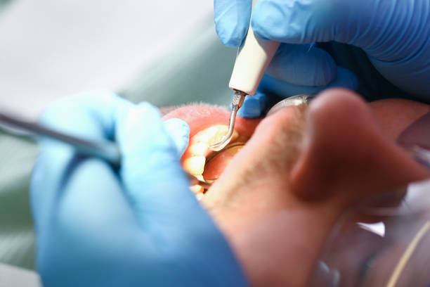 Best Weekend Emergency Dentist in Allen, TX