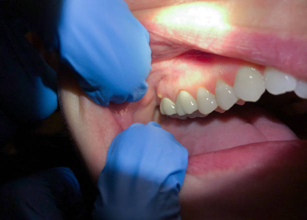 Best Orthodontic Emergency Dentist in Allen, TX