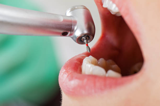 Best Emergency Cosmetic Dentistry in Allen, TX